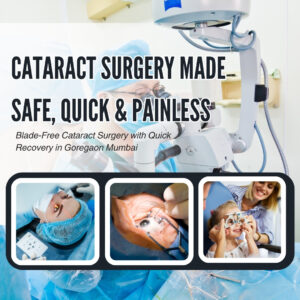 cataract surgery
