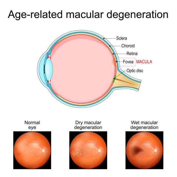8. Macular Degeneration Care & Advanced Retina Treatment