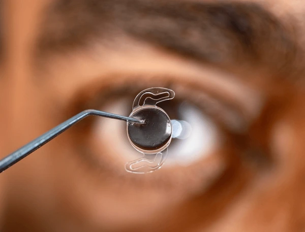 1. Advanced Cataract Diagnosis & Phacoemulsification Cataract Surgery