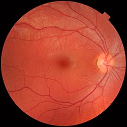 Will my eyes be dilated?