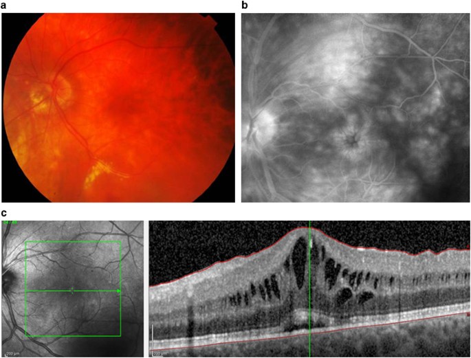 9. Uveitis & Eye Inflammation Care by a UK NHS-Trained Specialist